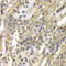 Enhancer of filamentation 1 antibody, A2521, ABclonal Technology, Immunohistochemistry paraffin image 