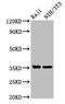 Nectin Cell Adhesion Molecule 4 antibody, CSB-PA822274LA01HU, Cusabio, Western Blot image 