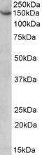 Patched Domain Containing 1 antibody, 42-686, ProSci, Western Blot image 