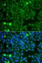 Cytosolic beta-glucosidase antibody, orb373792, Biorbyt, Immunofluorescence image 