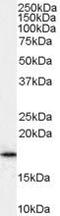 ADP Ribosylation Factor 1 antibody, PA5-18627, Invitrogen Antibodies, Western Blot image 