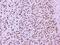 NOVA Alternative Splicing Regulator 1 antibody, A06087-1, Boster Biological Technology, Immunohistochemistry paraffin image 