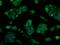 Tubulin Tyrosine Ligase Like 12 antibody, LS-C114865, Lifespan Biosciences, Immunofluorescence image 