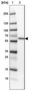 Solute Carrier Family 13 Member 1 antibody, NBP2-30984, Novus Biologicals, Western Blot image 