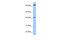 Pygopus Family PHD Finger 1 antibody, A10797, Boster Biological Technology, Western Blot image 