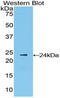 Interferon Beta 1 antibody, LS-C304852, Lifespan Biosciences, Western Blot image 