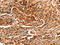 Galectin 1 antibody, CSB-PA794383, Cusabio, Immunohistochemistry frozen image 