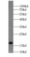 Transmembrane Protein 70 antibody, FNab08789, FineTest, Western Blot image 