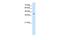 Tetraspanin 12 antibody, GTX46390, GeneTex, Western Blot image 