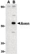 Apoptosis And Caspase Activation Inhibitor antibody, PA5-20287, Invitrogen Antibodies, Western Blot image 
