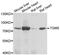 Transglutaminase 5 antibody, A7039, ABclonal Technology, Western Blot image 