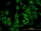 Rho Associated Coiled-Coil Containing Protein Kinase 1 antibody, LS-C198099, Lifespan Biosciences, Immunofluorescence image 