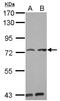 Pumilio RNA Binding Family Member 3 antibody, LS-C155561, Lifespan Biosciences, Western Blot image 