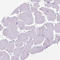 Proteoglycan 2, Pro Eosinophil Major Basic Protein antibody, HPA038515, Atlas Antibodies, Immunohistochemistry paraffin image 