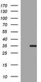 Snail Family Transcriptional Repressor 1 antibody, TA506430, Origene, Western Blot image 