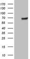 Thyroid Hormone Receptor Alpha antibody, TA805144S, Origene, Western Blot image 