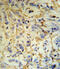 Fibrinogen Alpha Chain antibody, 62-497, ProSci, Immunohistochemistry paraffin image 