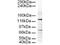 AP-3 complex subunit delta-1 antibody, A07250, Boster Biological Technology, Western Blot image 