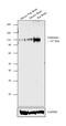 Glutamate Ionotropic Receptor NMDA Type Subunit 1 antibody, OMA1-04010, Invitrogen Antibodies, Western Blot image 