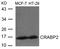 CRABP-II antibody, A03297, Boster Biological Technology, Western Blot image 