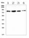 Interleukin 1 Receptor Associated Kinase 1 antibody, A01021-1, Boster Biological Technology, Western Blot image 