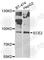 Endothelin-converting enzyme 2 antibody, A7049, ABclonal Technology, Western Blot image 