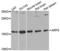 ADP Ribosylation Factor 6 antibody, LS-C331185, Lifespan Biosciences, Western Blot image 