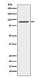 Prolactin Receptor antibody, M01196-2, Boster Biological Technology, Western Blot image 