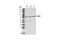 Glutamine--Fructose-6-Phosphate Transaminase 1 antibody, 3818S, Cell Signaling Technology, Western Blot image 