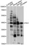 Factor VIII intron 22 protein antibody, LS-C749790, Lifespan Biosciences, Western Blot image 