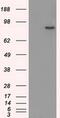 SATB Homeobox 1 antibody, MA5-24946, Invitrogen Antibodies, Western Blot image 