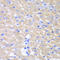 Glycerol-3-Phosphate Acyltransferase, Mitochondrial antibody, STJ28693, St John