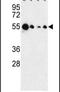 Absent In Melanoma 2 antibody, PA5-26874, Invitrogen Antibodies, Western Blot image 