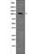 Catenin Delta 1 antibody, PA5-64666, Invitrogen Antibodies, Western Blot image 