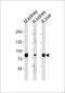 Enoyl-CoA Hydratase And 3-Hydroxyacyl CoA Dehydrogenase antibody, MBS9205393, MyBioSource, Western Blot image 