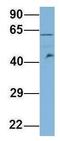 Microtubule Associated Protein 11 antibody, GTX44954, GeneTex, Western Blot image 