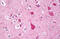 Endoplasmic Reticulum To Nucleus Signaling 1 antibody, MBS243697, MyBioSource, Immunohistochemistry frozen image 