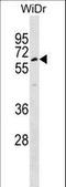 Tubby-related protein 1 antibody, LS-C160343, Lifespan Biosciences, Western Blot image 