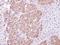Charged multivesicular body protein 5 antibody, NBP1-32597, Novus Biologicals, Immunohistochemistry frozen image 