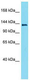 Serine/threonine-protein kinase LMTK3 antibody, TA332281, Origene, Western Blot image 