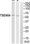 TRNA Splicing Endonuclease Subunit 54 antibody, TA316310, Origene, Western Blot image 