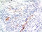 TGF beta antibody, M00019-1, Boster Biological Technology, Immunohistochemistry paraffin image 