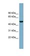 Colony Stimulating Factor 1 antibody, orb325141, Biorbyt, Western Blot image 