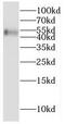 Cytochrome P450 2W1 antibody, FNab02164, FineTest, Western Blot image 