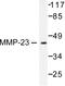 Matrix Metallopeptidase 23B antibody, AP06232PU-N, Origene, Western Blot image 