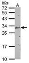 Synaptonemal Complex Protein 3 antibody, GTX101207, GeneTex, Western Blot image 