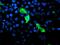 GTPase, IMAP Family Member 4 antibody, MA5-25982, Invitrogen Antibodies, Immunocytochemistry image 