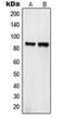 Semaphorin-4A antibody, MBS820155, MyBioSource, Western Blot image 