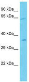 Ankyrin Repeat Domain 55 antibody, TA330744, Origene, Western Blot image 