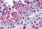 Karyopherin Subunit Alpha 5 antibody, 5989, ProSci, Immunohistochemistry paraffin image 